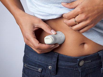 MiniMed Mio® Advance Clear Infusion Set-Top View