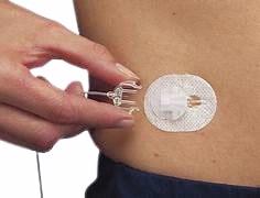 MiniMed Mio® Advance Clear Infusion Set-In Use
