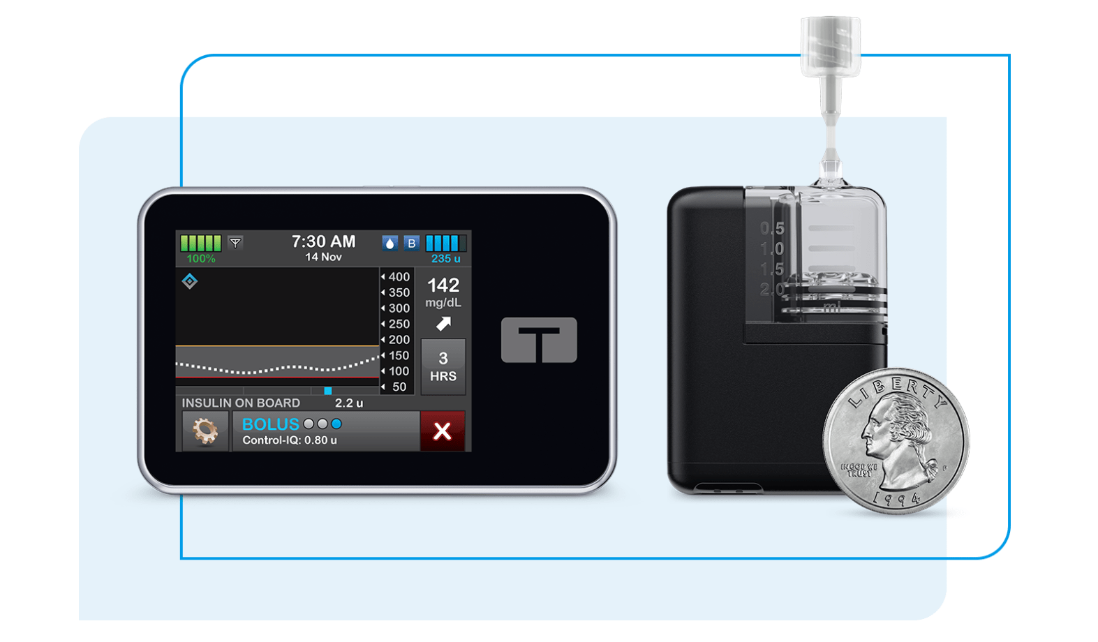 Digital Basal/Bolus Delivery Device